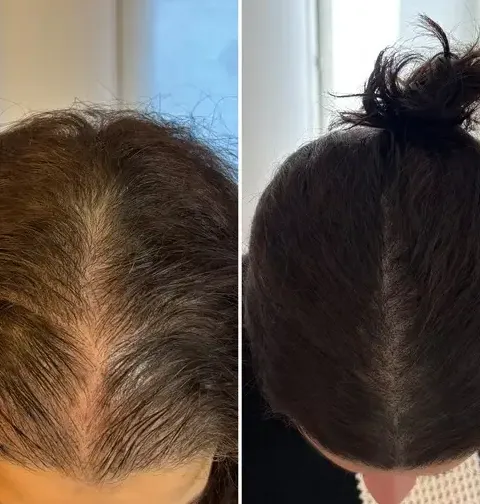 Cheveux très fins